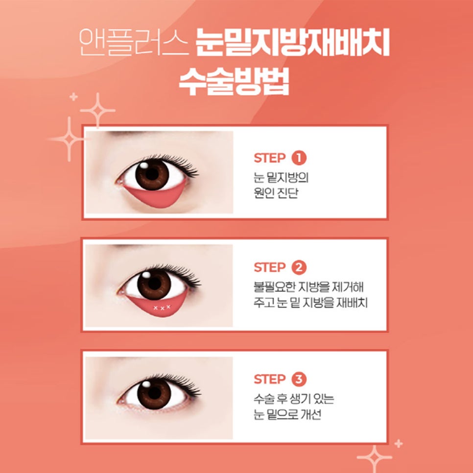 다크서클과 비염! 관계가 있을까요? 관련 이미지 4