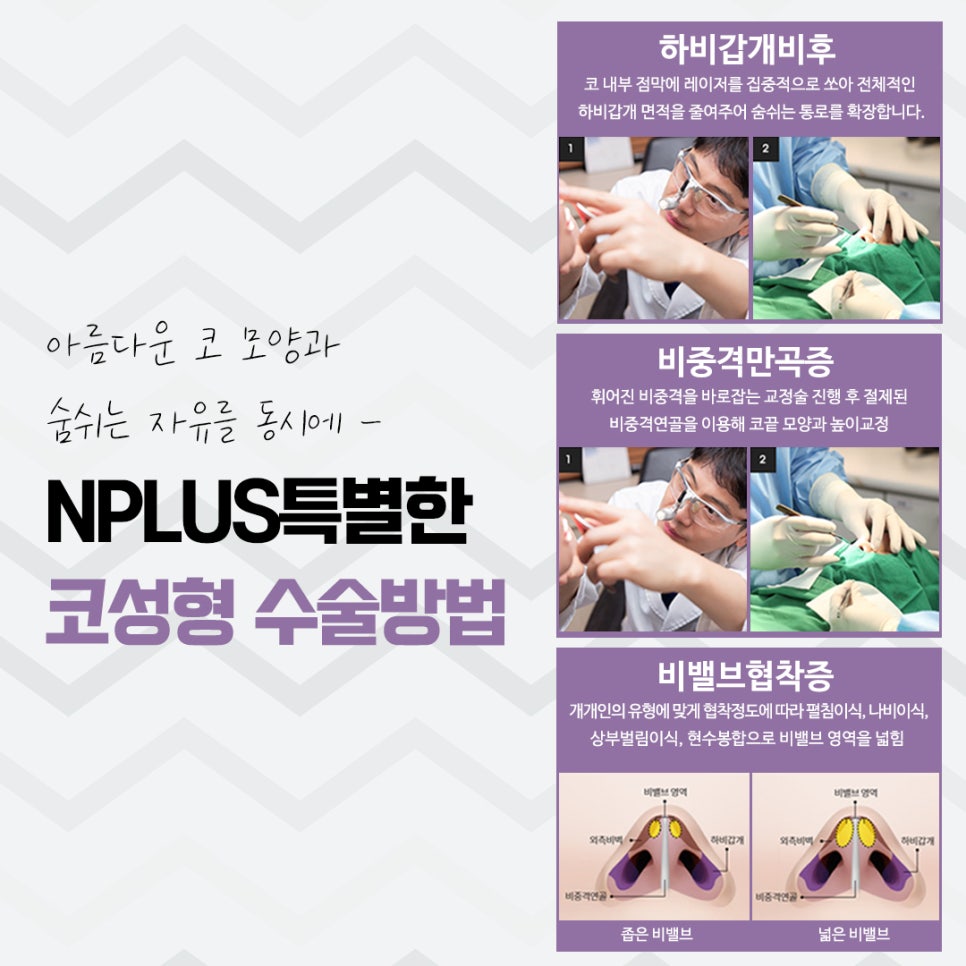 Before and After Nose Surgery: Looking into It Carefully image 9
