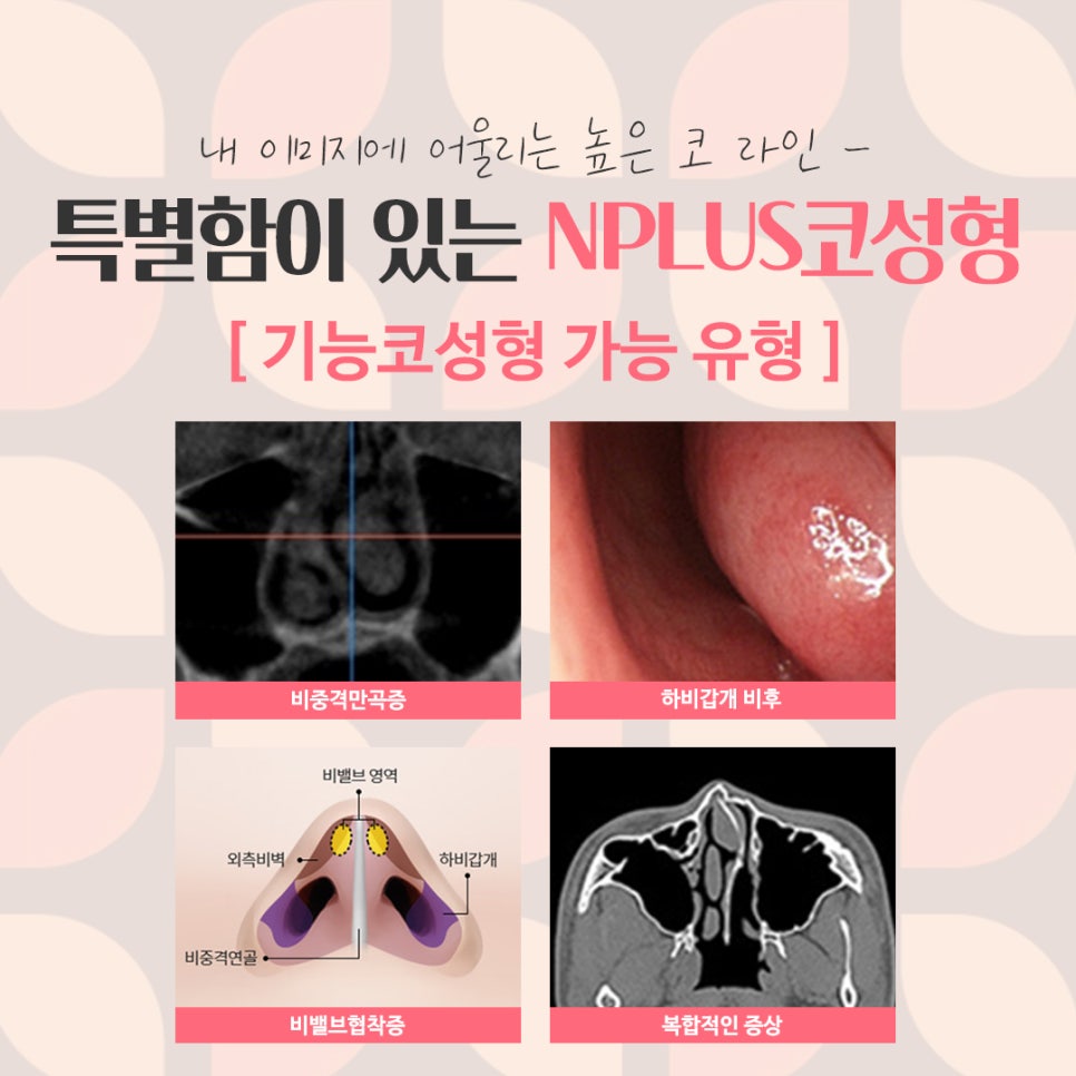 여자코수술후기 정확한 진단으로 관련 이미지 5