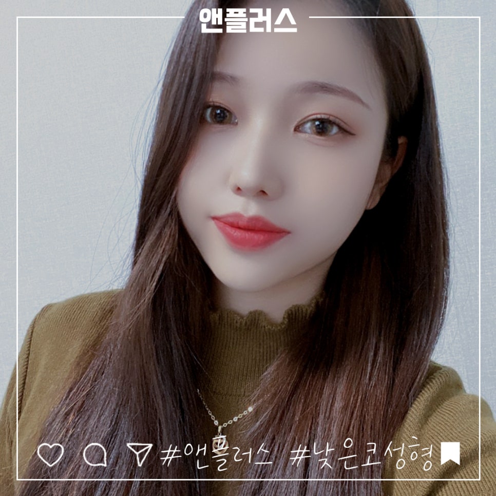 낮은코수술후기 세련된 코라인으로 관련 이미지 5