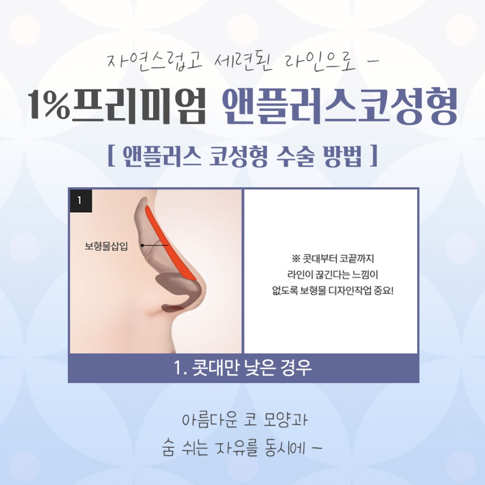 늑연골코성형을 고민한다면 관련 이미지 7