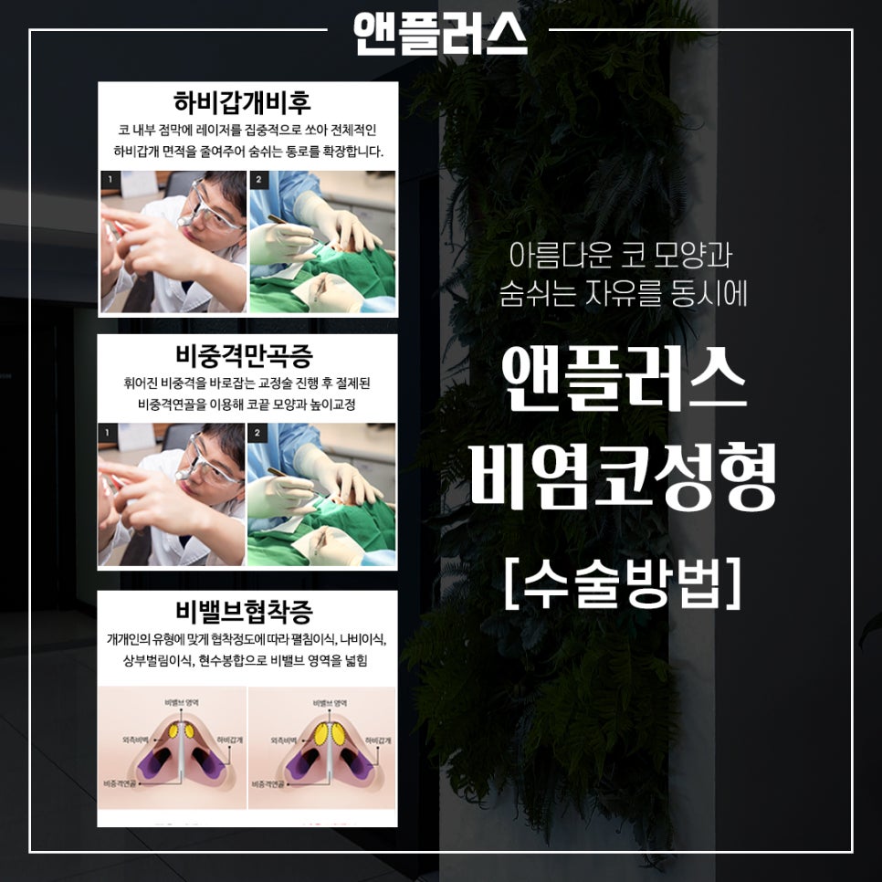 코막힘원인은? 코 안을 잘 봐야 합니다. 관련 이미지 5