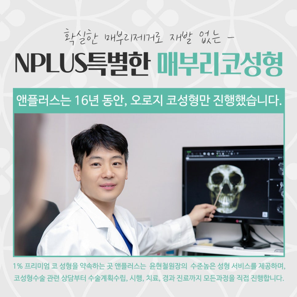 매부리코성형후기 부드러운 인상으로 관련 이미지 7