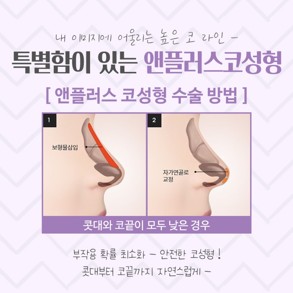 코수술후기를 통해 내게 어울리는 라인으로 관련 이미지 7