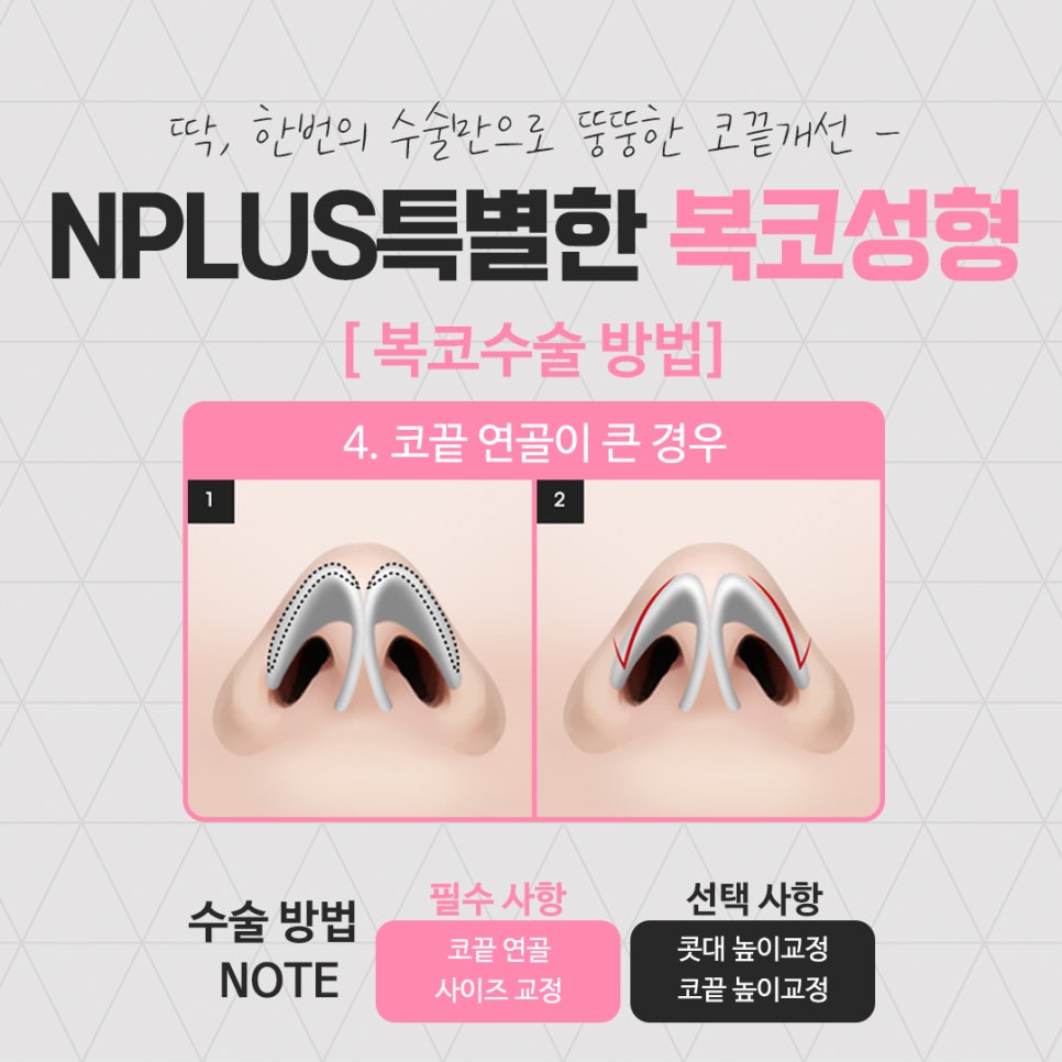 복코성형 세련된 이미지로 관련 이미지 12