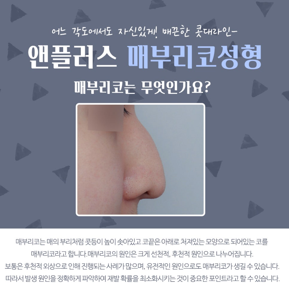 남자매부리코성형 기능까지 고려해서 관련 이미지 3