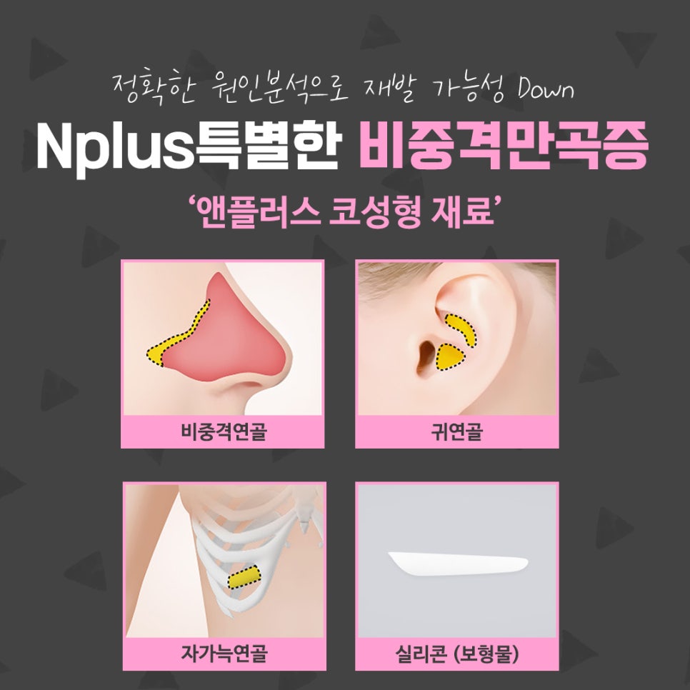 비중격만곡증수술 신중한 선택으로 관련 이미지 10