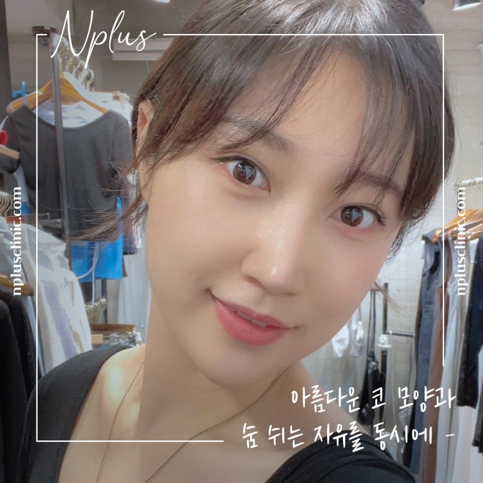 자가늑연골코성형을 통한 이미지 개선 관련 이미지 1