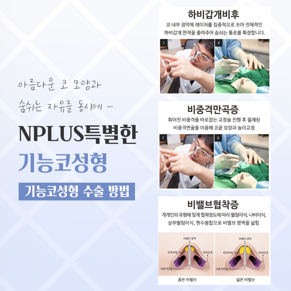 기능코성형 후기 보고 비교하여 관련 이미지 9