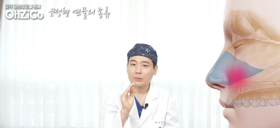 코성형 재료 연골의 종류와 특징! 관련 이미지 8