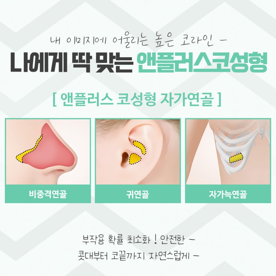 코성형후기 자연스러운 코라인으로 관련 이미지 11