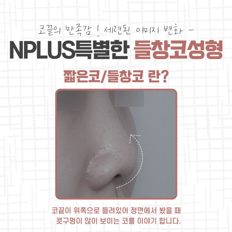 들창코성형 선택의 중요성 관련 이미지 3