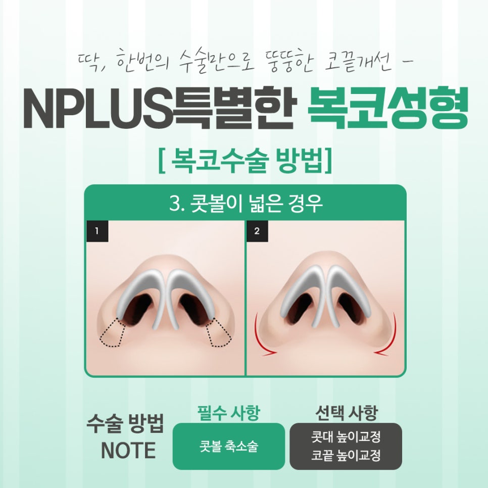 Looking into Various Bulbous Nose Surgery Reviews image 9