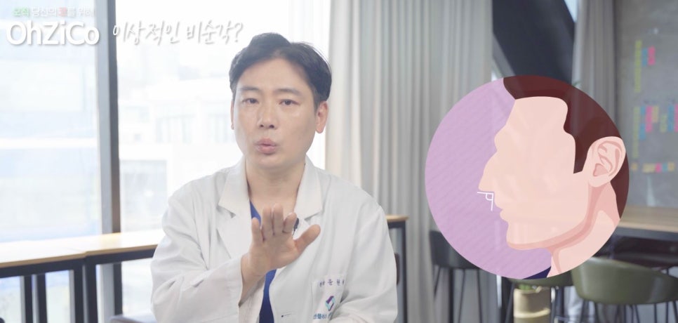 비순각수술 자연스럽고 예쁘게 관련 이미지 13