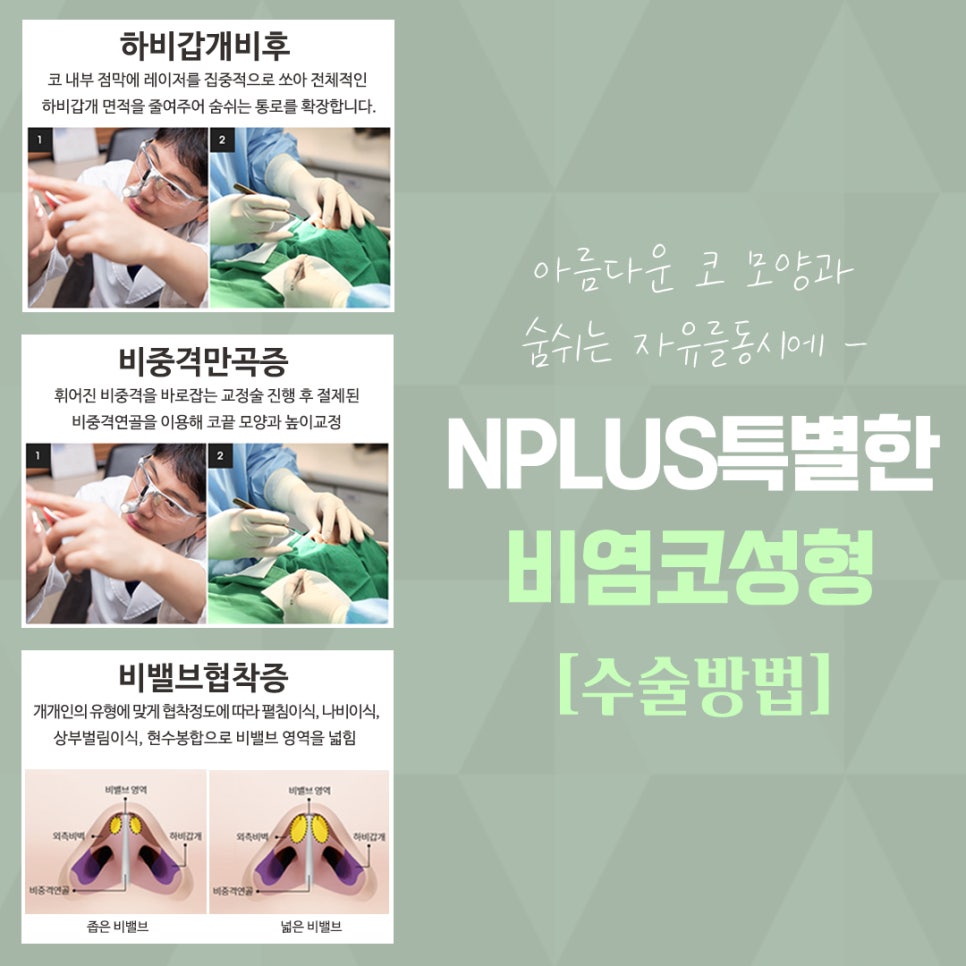 Review of Rhinitis Nose Surgery: Looking for the Differences image 8