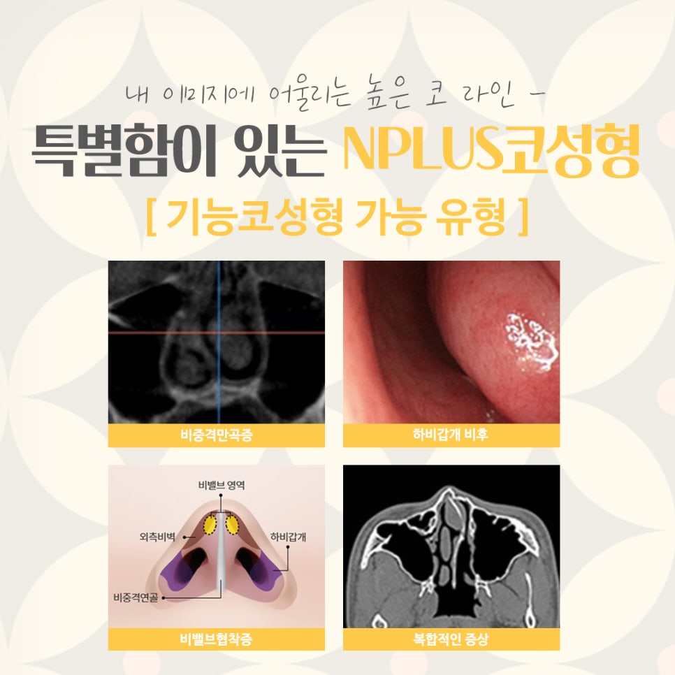 코성형잘하는병원에 대해 알아보고 관련 이미지 5