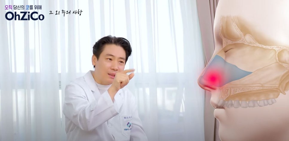 앤플러스에서 전달드리는 코성형주의사항 관련 이미지 13