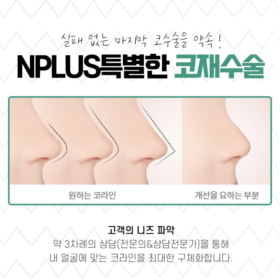 코재수술성형외과 신중하게 알아보고 관련 이미지 7