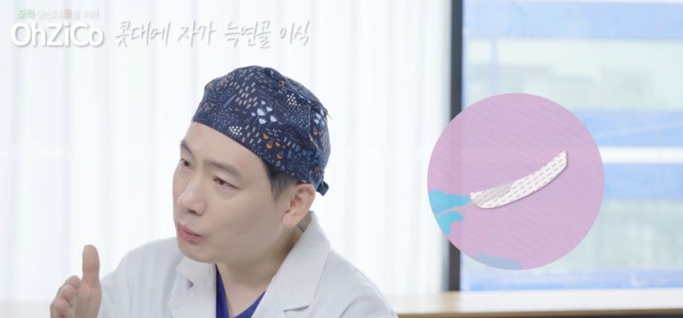 콧대성형에 사용되는 자가보형물 관련 이미지 9