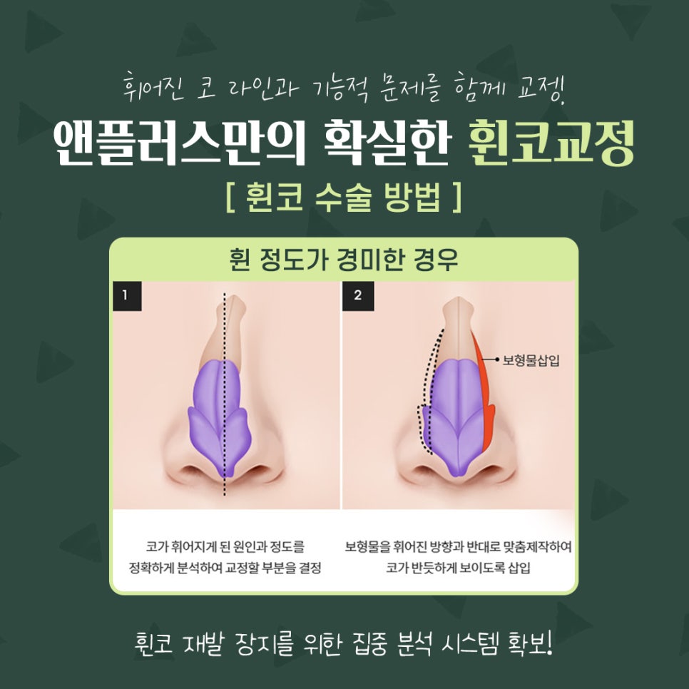 A Thorough Analysis for Reliable Crooked Nose Correction Reviews image 7
