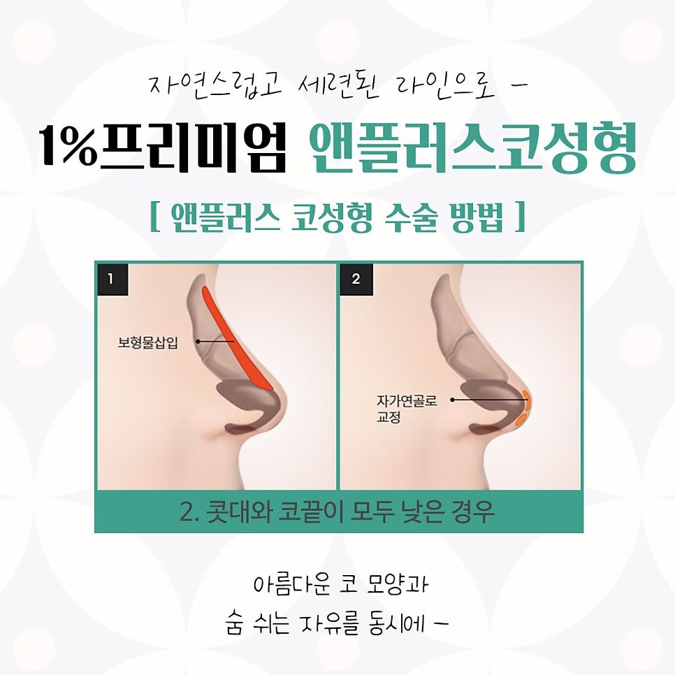 Learn About Autologous Rib Cartilage Nose Surgery Accurately image 10