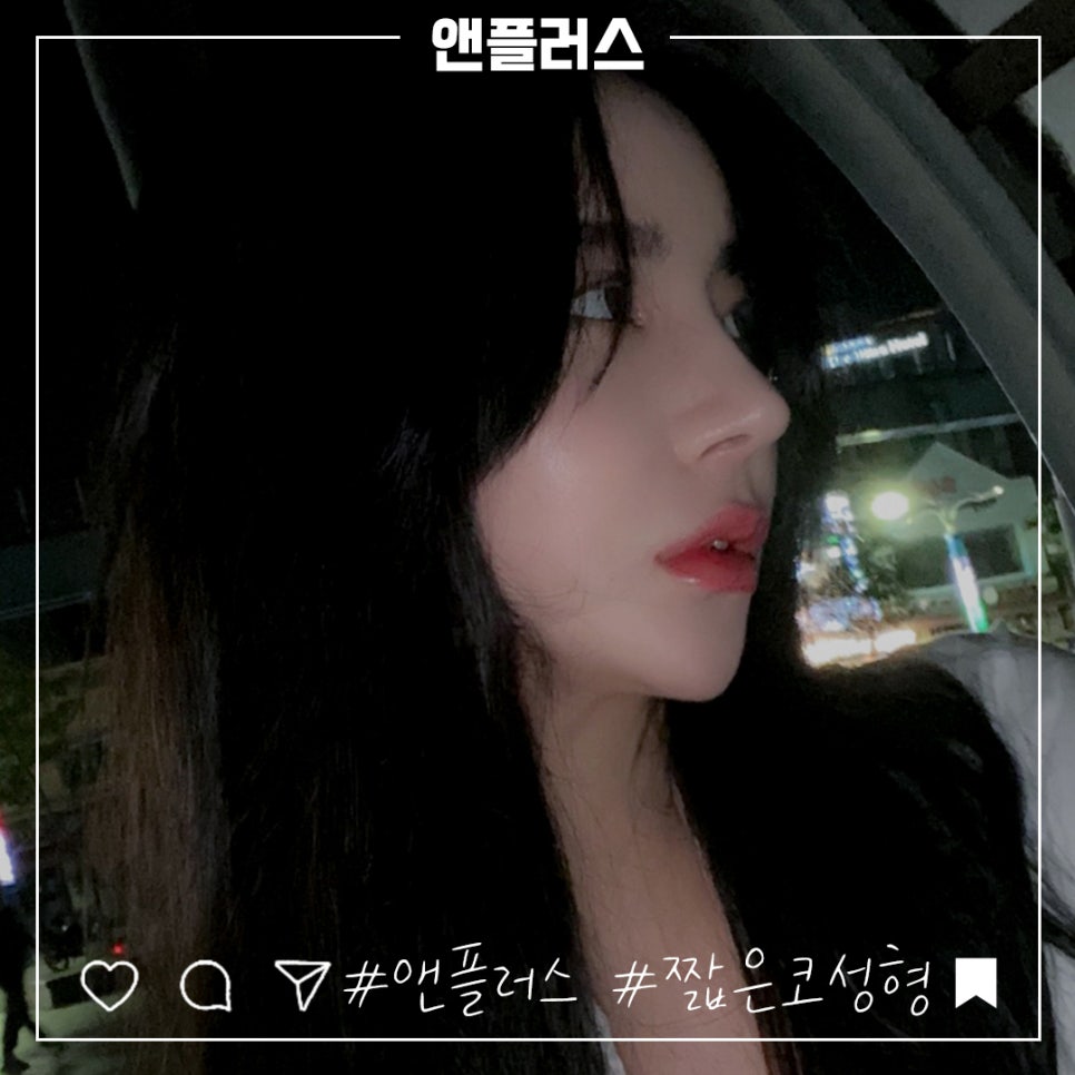 A Beautiful Nose Line with Short Nose Surgery image 1