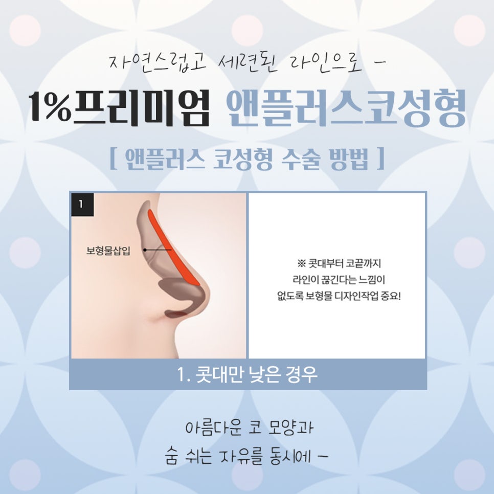 Reviewing and Deciding on Self-Rib Nose Surgery Reviews image 7
