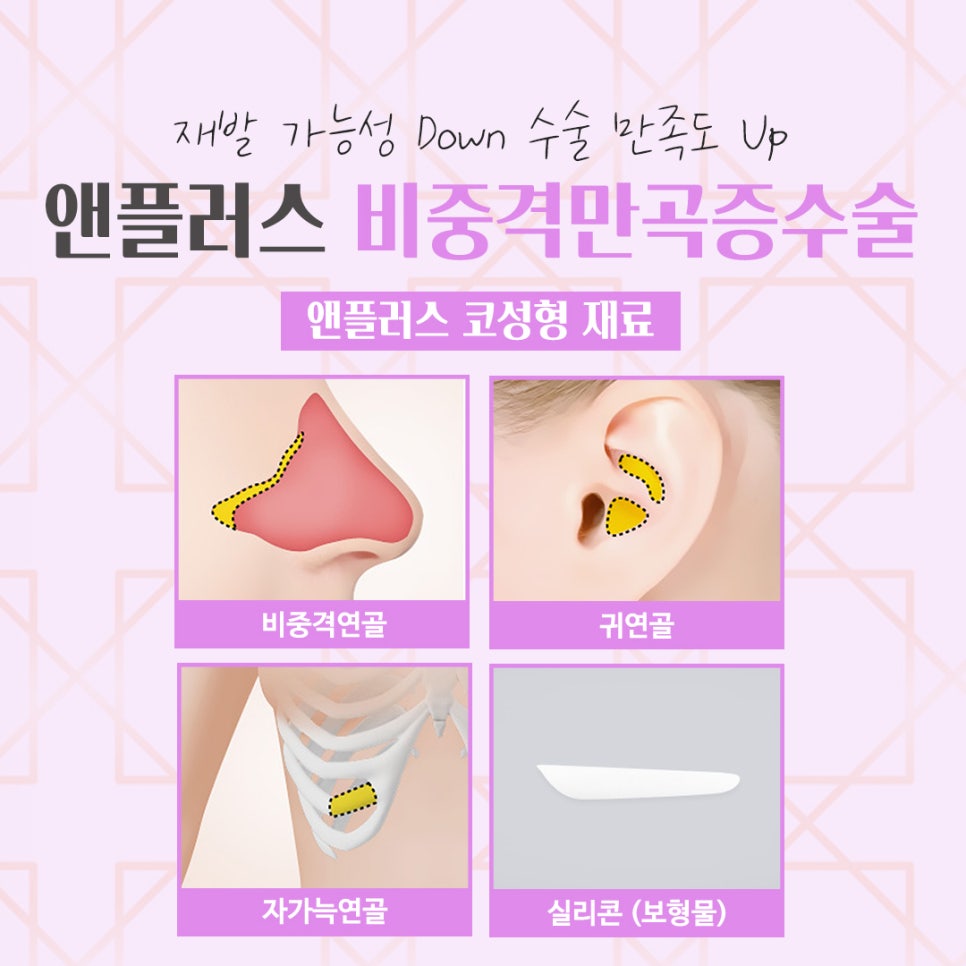 비중격만곡증수술후기 원인과 해결 방법까지 관련 이미지 11