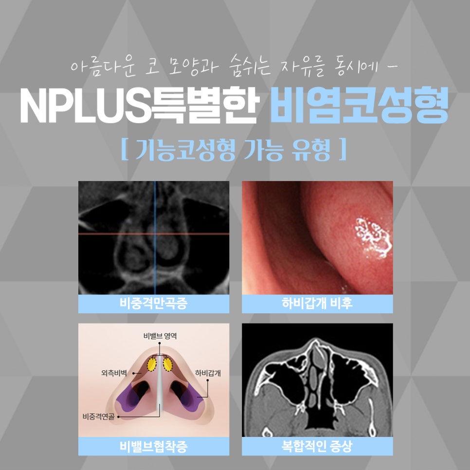 The Importance of Choosing a Nasal Surgery Review image 7
