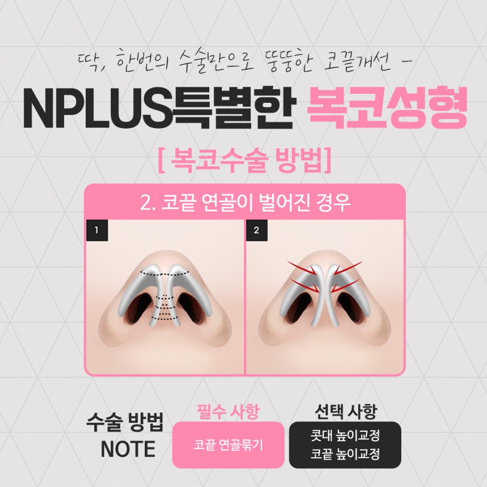 복코성형 세련된 이미지로 관련 이미지 10