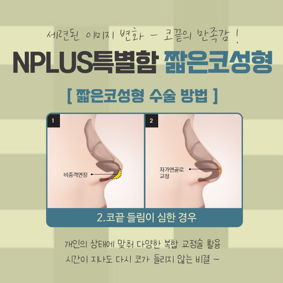 짧은코성형을 통한 자신감 회복 관련 이미지 9