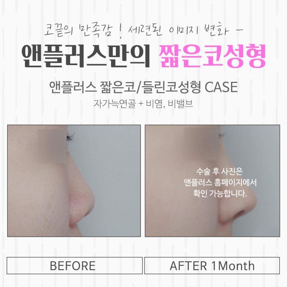 짧은코성형을 통해 세련된 이미지로 관련 이미지 15