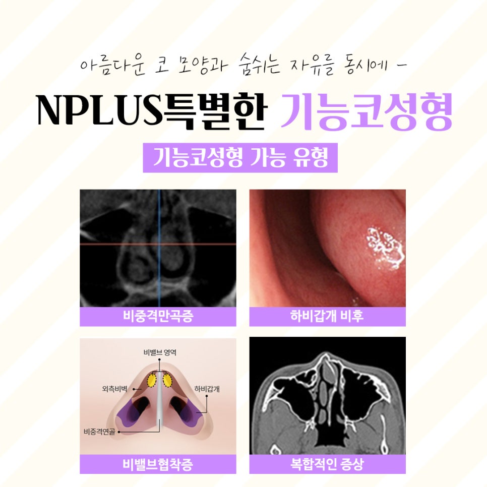 Accurately Reviewing Rhinoplasty Experience image 5