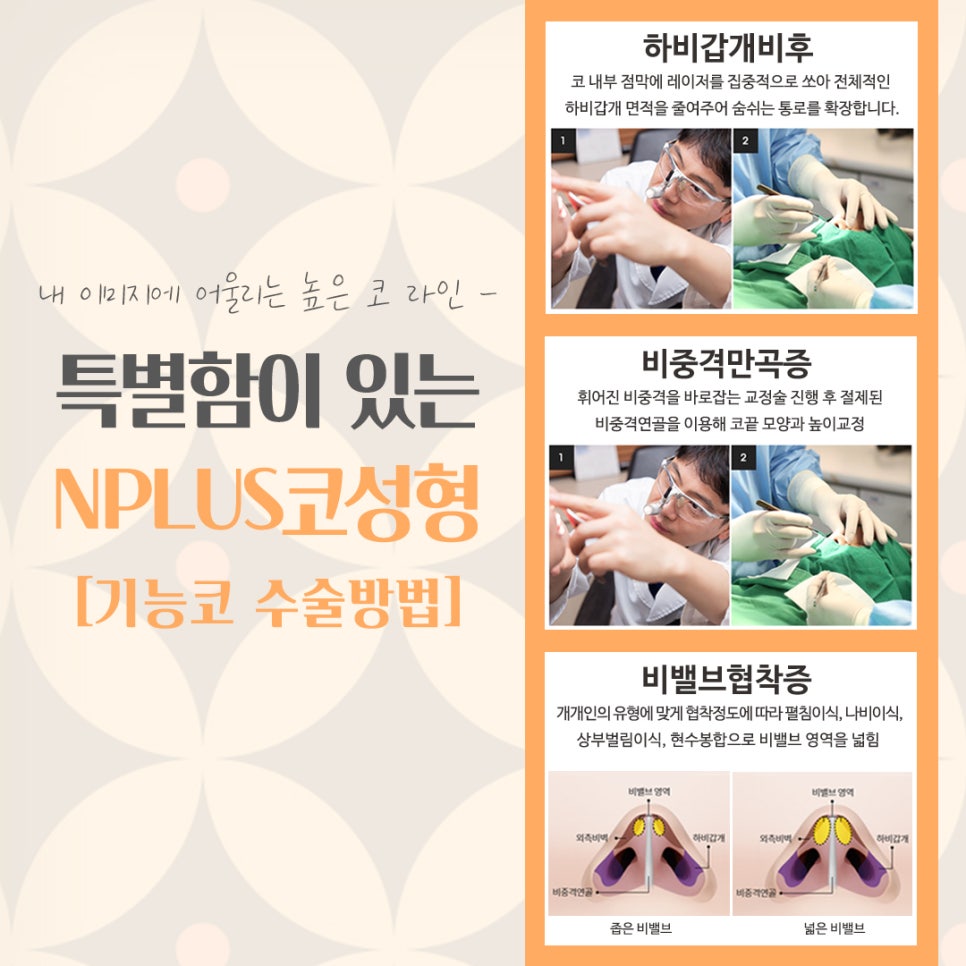 서울성형외과에서 알아본 코수술후기 관련 이미지 11