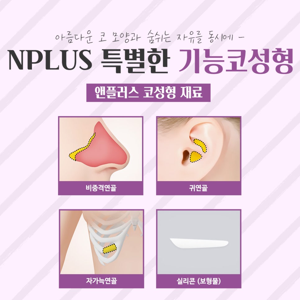 Before and After Female Nose Surgery in Various Ways image 8