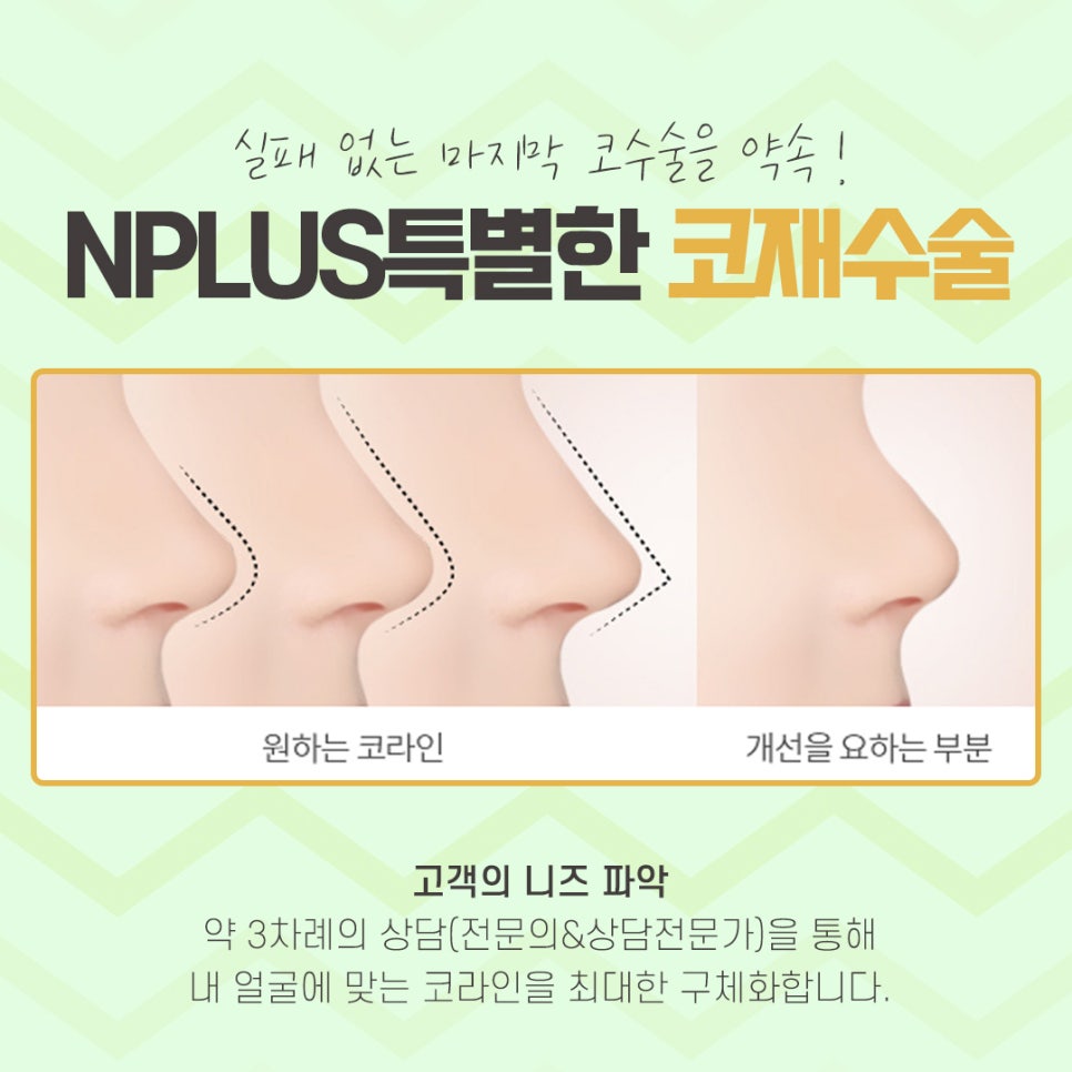 Nose Revision Surgery Review Considering Function as Well image 5