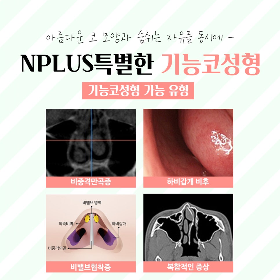 코성형후기 제대로 알아보고 관련 이미지 5