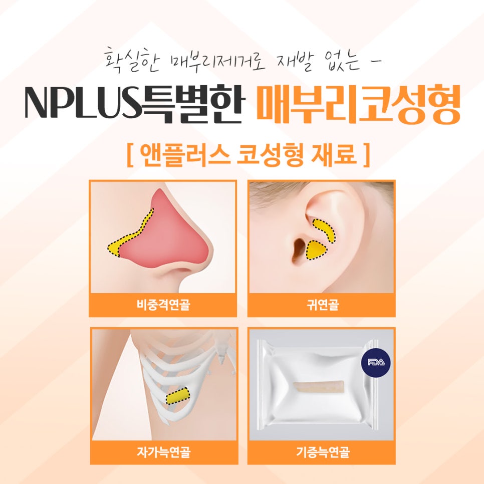 매부리코성형후기를 자세하게 알아보고 관련 이미지 11
