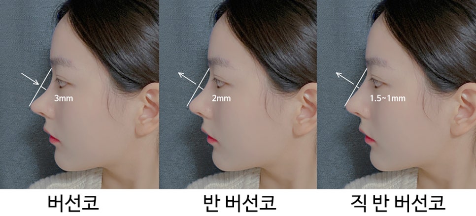 What Is the Prettiest Nose That Suits My Face Best? image 2