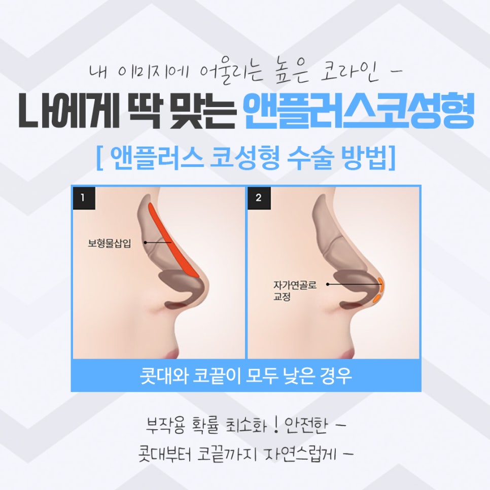코성형후기를 다양하게 찾아보고 관련 이미지 8