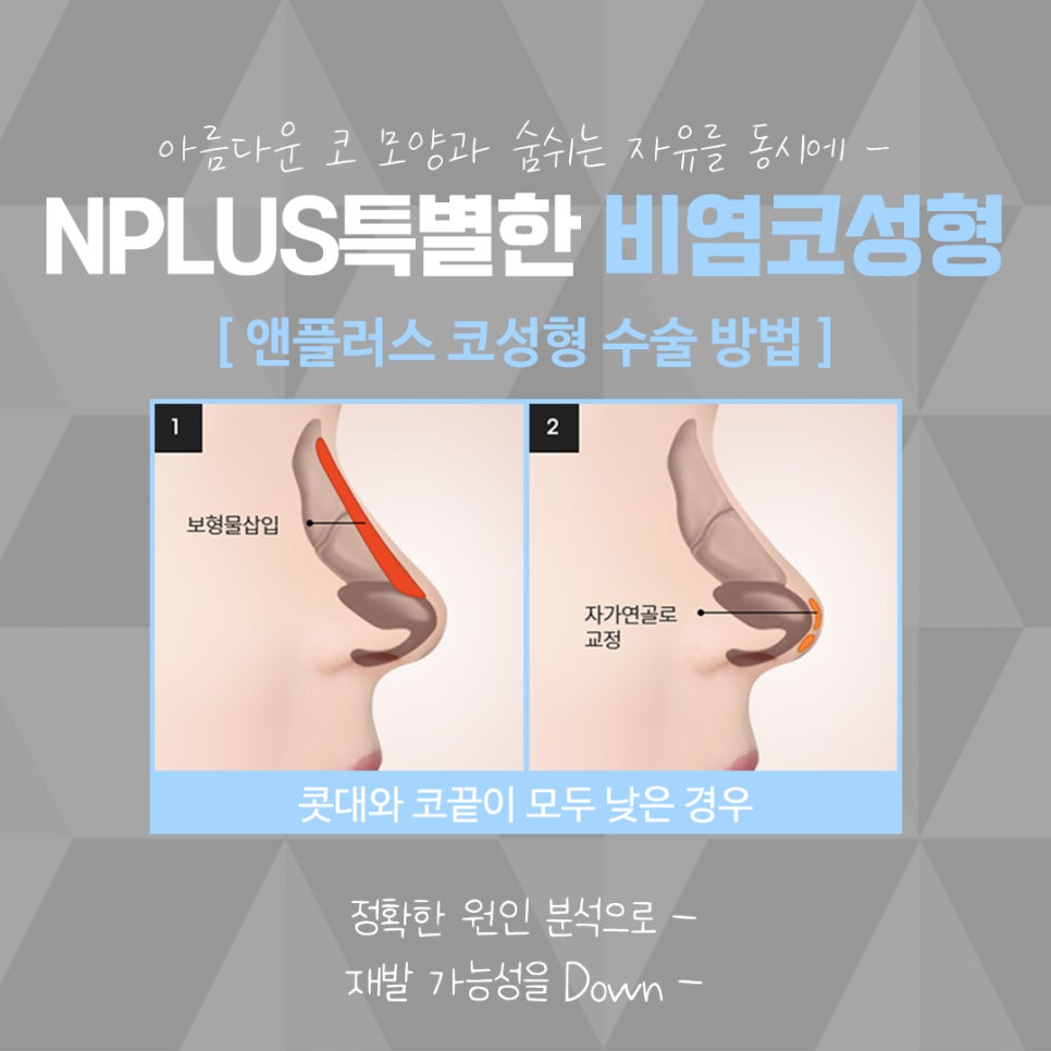 The Importance of Choosing a Nasal Surgery Review image 10