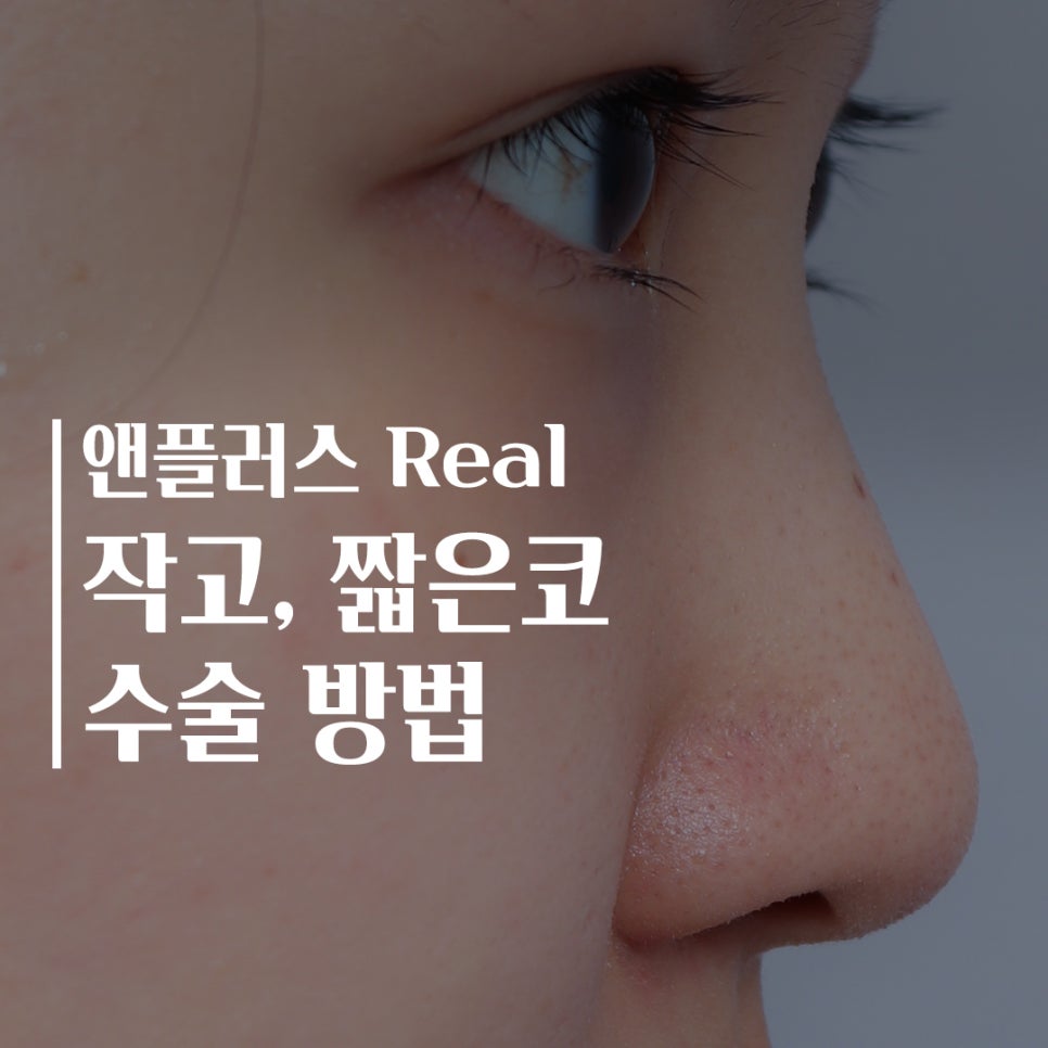 짧은코수술 후기까지 자세하게 알아보고 관련 이미지 1