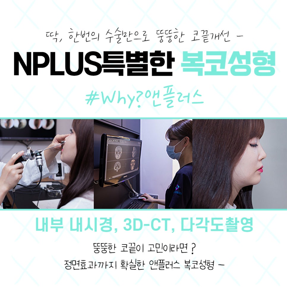 복코수술후기를 더욱 자세히 확인하고 관련 이미지 5
