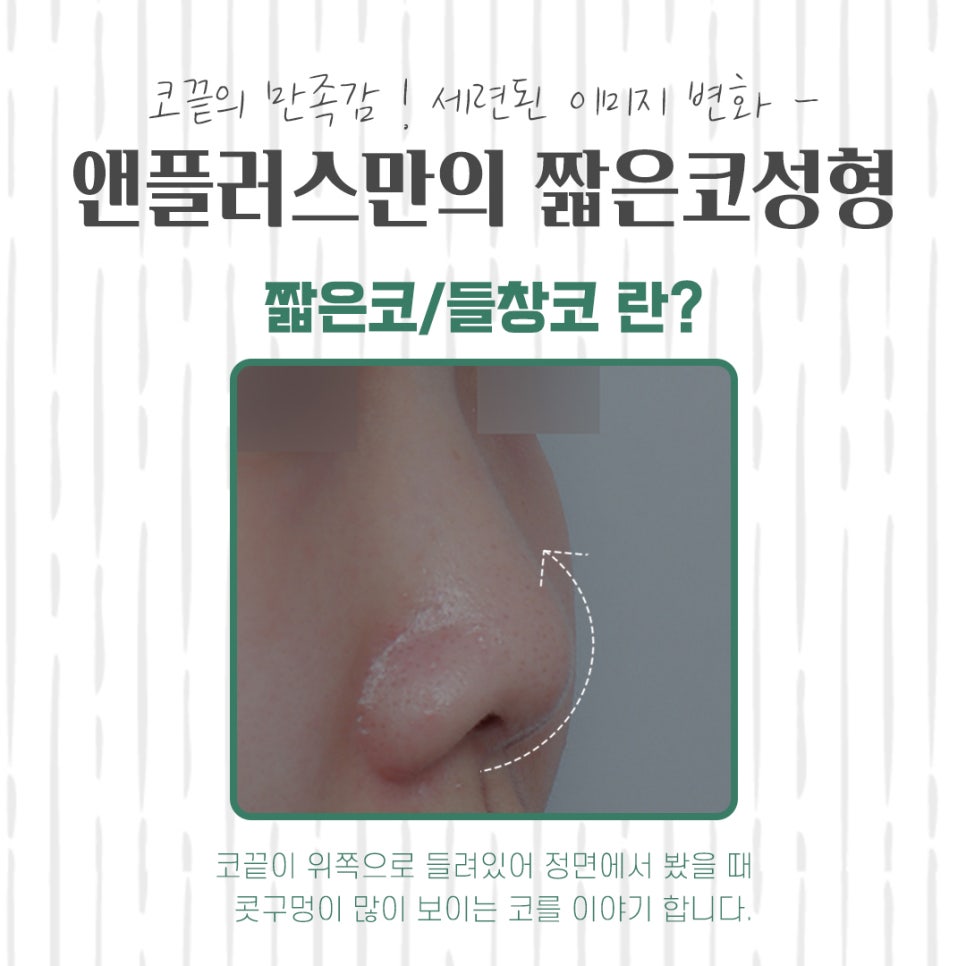 들린코수술후기 기능까지 확인하고 관련 이미지 5
