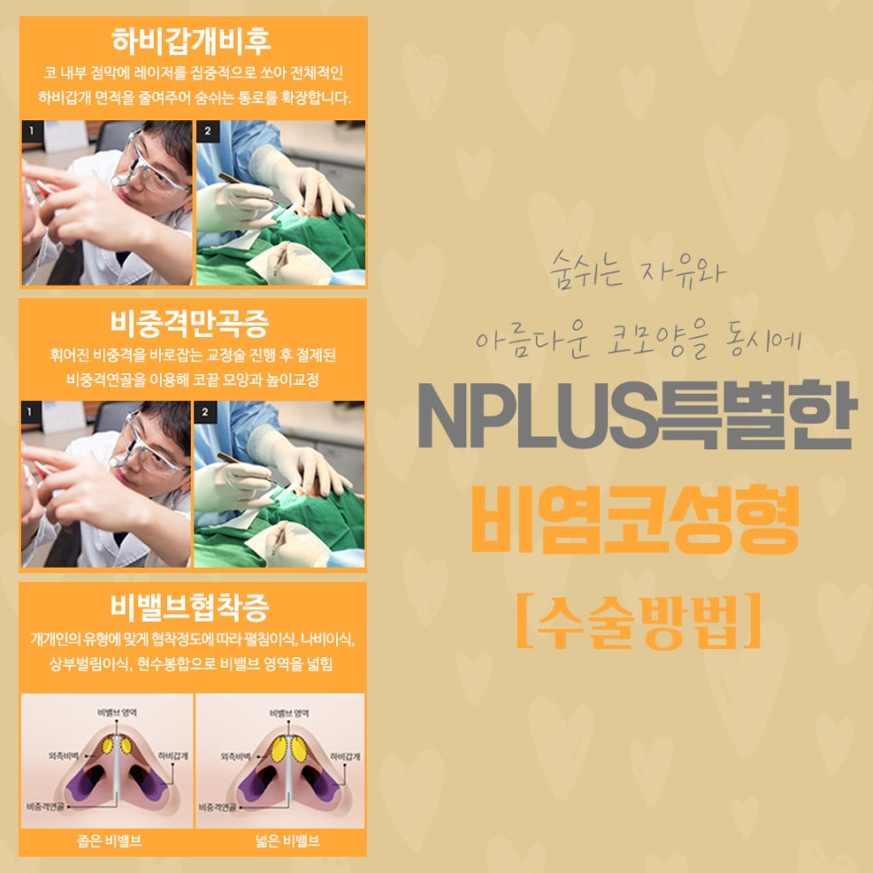 코막힘원인 정확하게 파악하는 것이 중요 관련 이미지 8