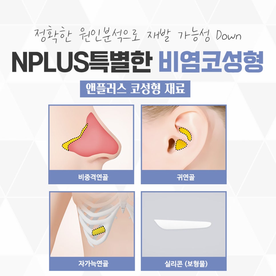 Nasal Surgery and Rhinoplasty: Identifying the Exact Cause image 10