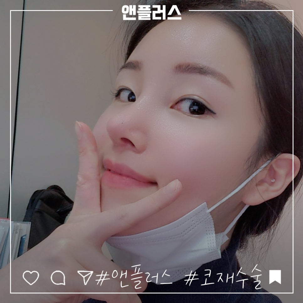 압구정성형외과에서 알아보는 코재수술후기 관련 이미지 7