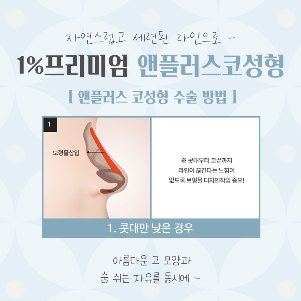 늑연골코수술 내용을 확인해 보고 관련 이미지 9