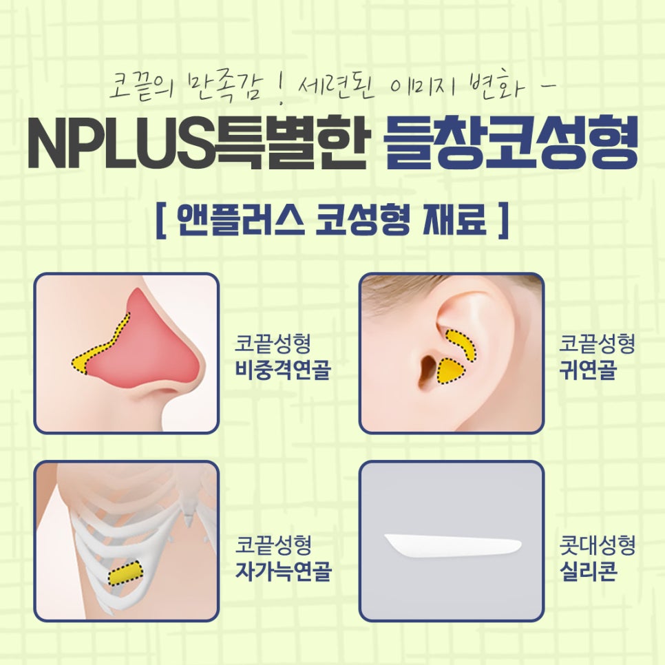 Significantly Improve an Upturned Nose with Surgery image 12
