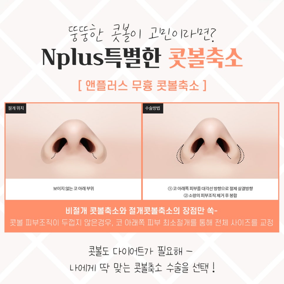 Looking Closely at Nostril Reduction Reviews image 7